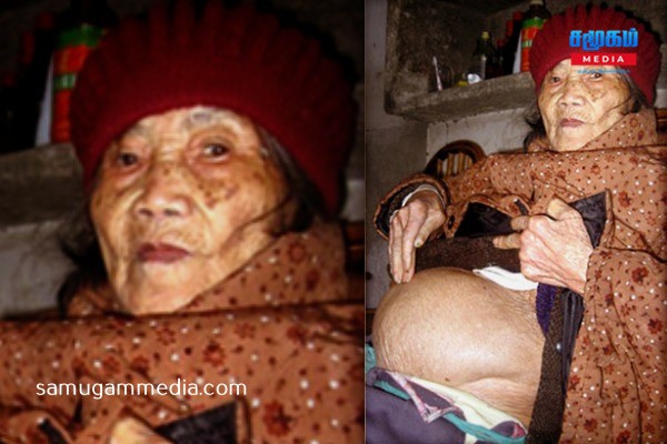 31 வயதில் கர்ப்பமாகி 92 வயதில் கல் குழந்தையைப் பெற்றெடுத்த சீனப் பெண்! samugammedia 